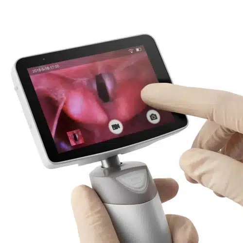 Video Laringoscopio Medcaptain VS-10S 2 Pantalla táctil del videolaringoscopio Medcaptain VS-10S durante su manejo