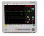 Monitor de pacientes Edan iM80 con visualización de parámetros