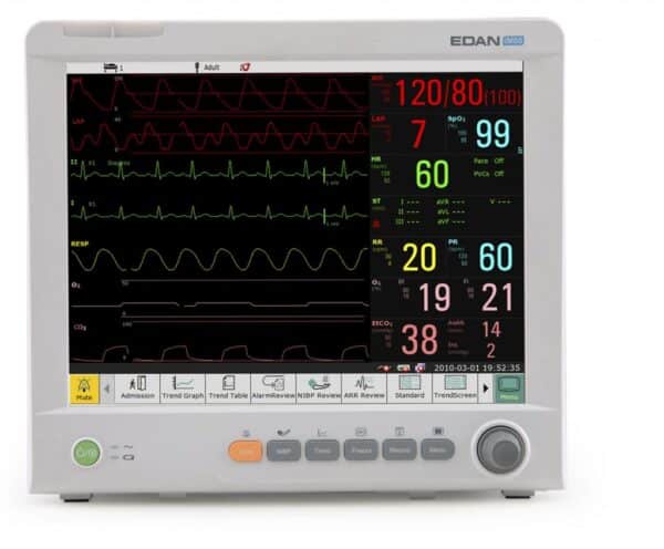 Monitor de pacientes Edan iM80 con visualización de parámetros