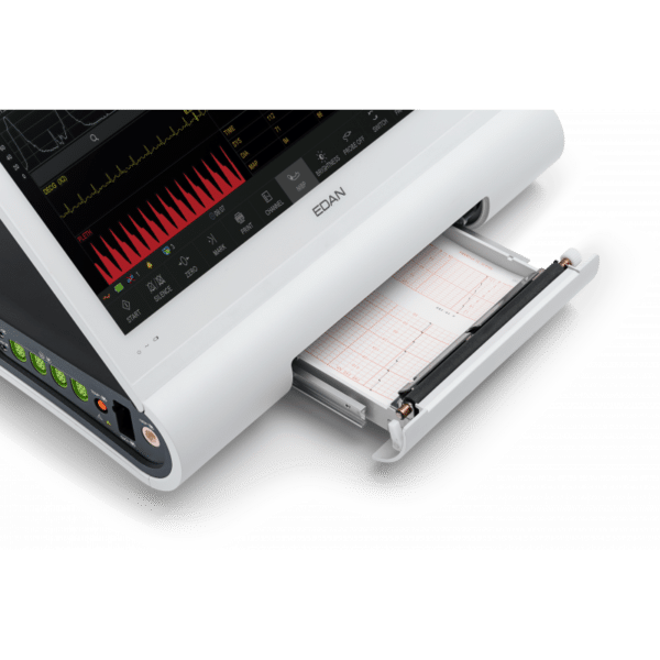Monitor fetal EDAN F15: detalle del registrador térmico integrado